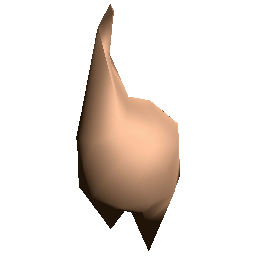 Putrid Incisor Tooth